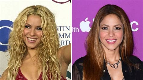 Shakira Plastic Surgery Journey: Breast。